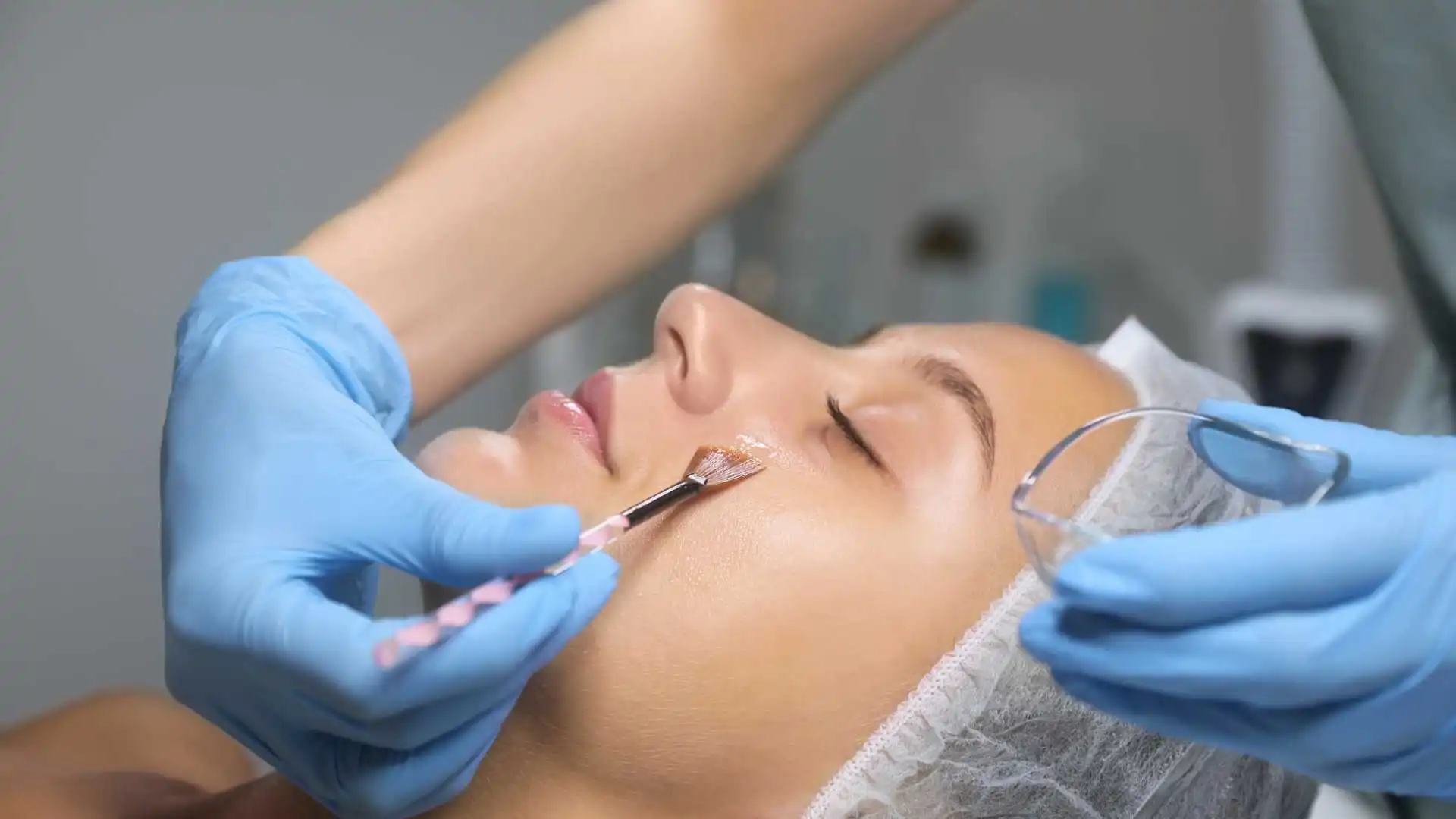 Chemical Peels in Vancouver, WA