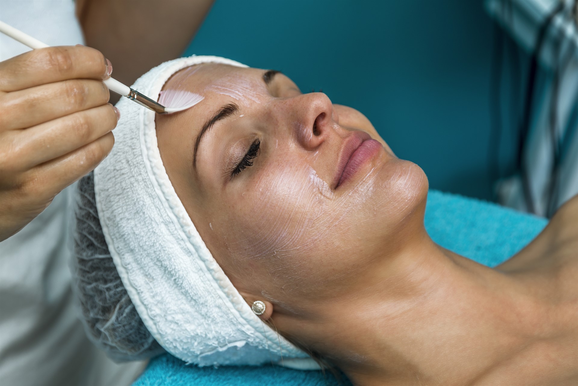 Chemical Peel in Vancouver, WA