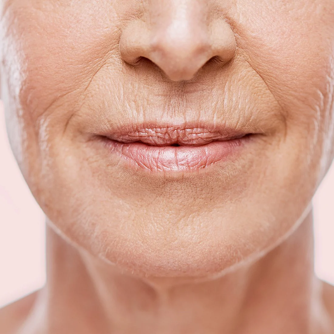 Fine lines and wrinkles