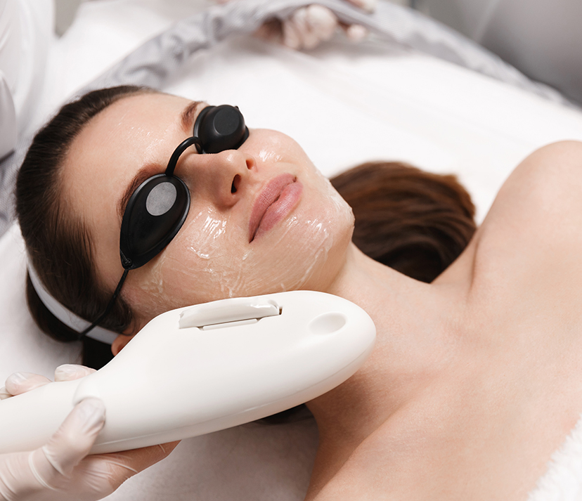 IPL (Photofacial) treatment in Vancouver, WA IPL (Photofacial) treatment in Vancouver, WA